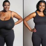A Comprehensive Guide to Breast Reduction Surgery