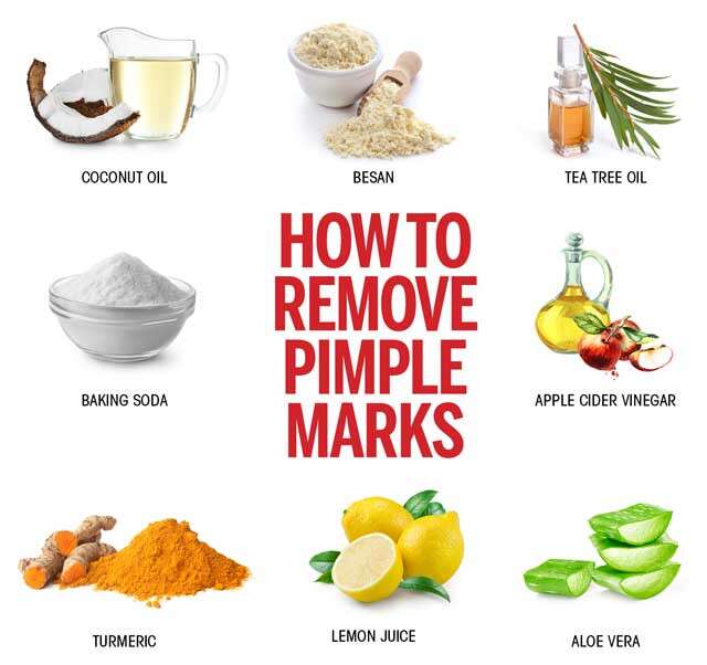 8 Ways to Remove Pimple Marks Naturally for Oily Skin
