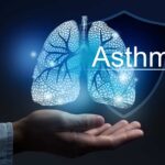 How to Manage Asthma Effectively